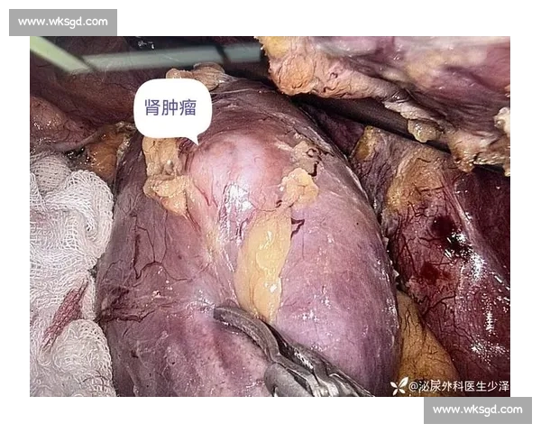 从肾癌病房到商业帝国:韦德如何用三重身份重塑人生 从肾癌病房到商业帝国:韦德如何用三重身份重塑人生